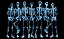 Fun Fact About Radiology