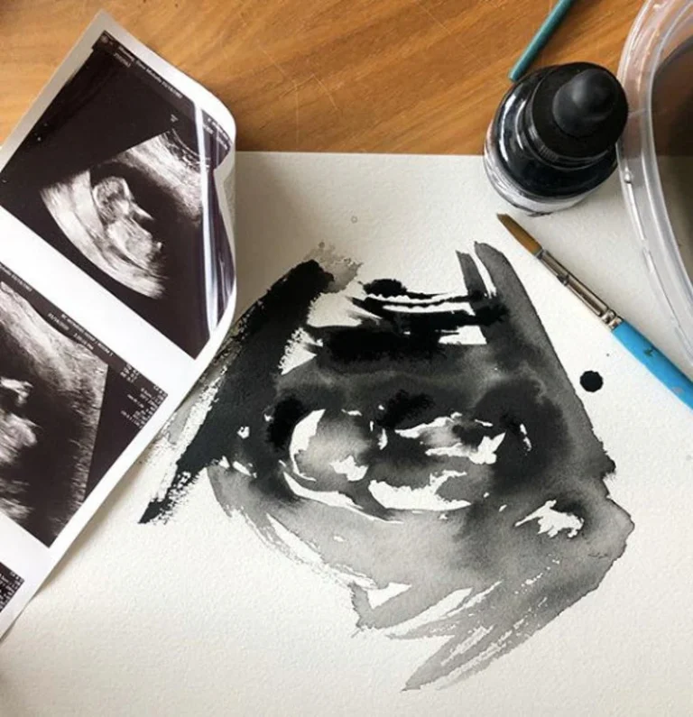 How Ultrasound Paints Pictures