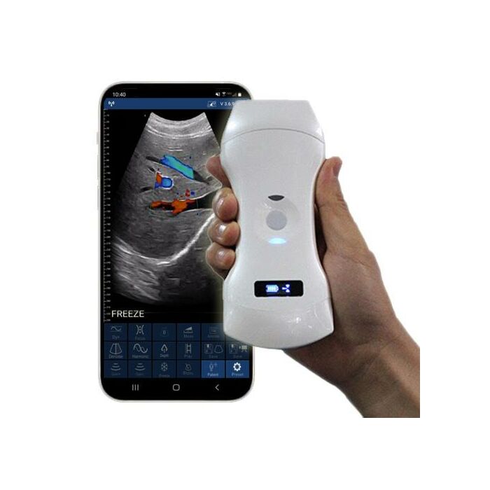 Portable Ultrasound
