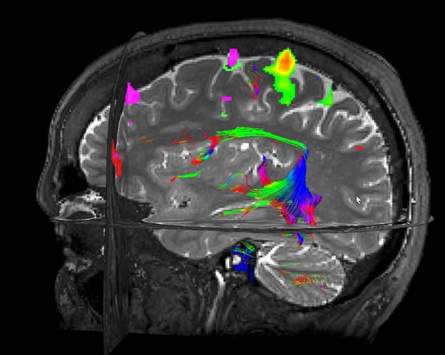 Understanding Functional MRI (fMRI)