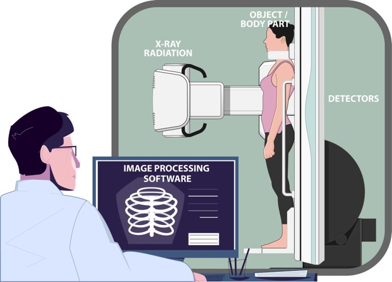 x ray medical equipment